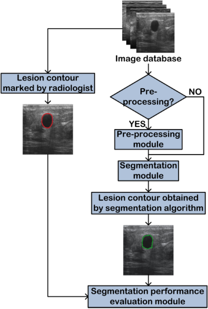 A Review Of Segmentation Algorithms Applied To B Mode Breast Ultrasound Images A Characterization Approach Springerlink