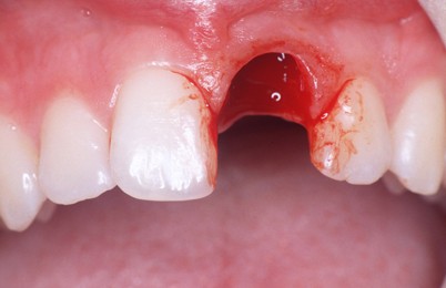 Finden Sie jetzt heraus, was Sie für schnelles steroide kur anleitung tun sollten.