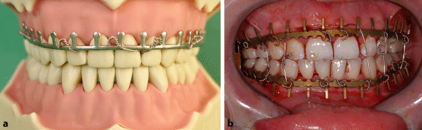 Dentales Trauma | SpringerLink