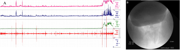 Etiology and Evaluation of Female Urethral Strictures | Current