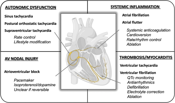 Management Of Arrhythmias Associated With Covid 19 Springerlink