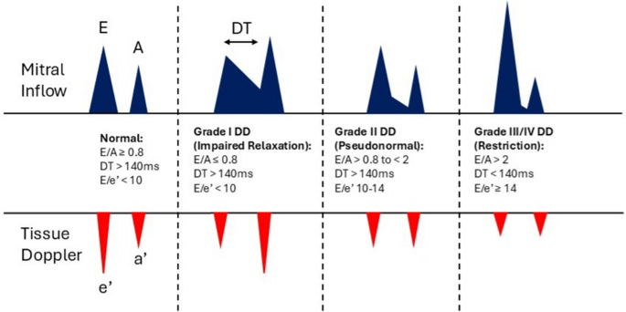 Addressing Diastolic Dysfunction in the Congenital Heart Population ...