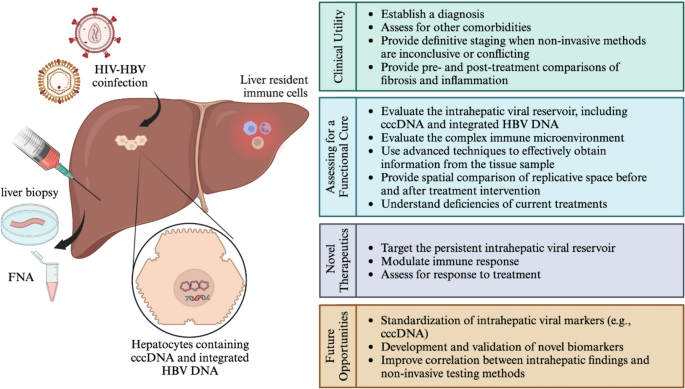 The Role of Liver Biopsy and Fine Needle Aspiration in Novel HBV ...