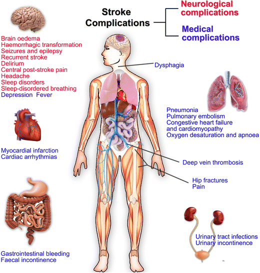 Causes Of Death Among Persons Who Survive An Acute Ischemic Stroke Springerlink