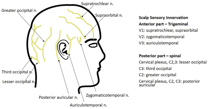 Postcraniotomy Headache: Etiologies and Treatments | SpringerLink