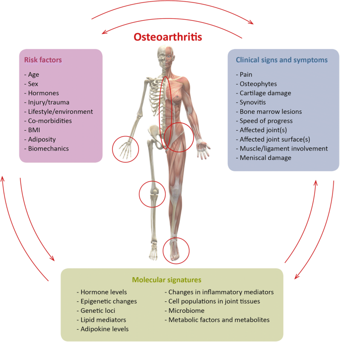 Osteoarthritis symptoms and signs. Fájdalom a fejízületben