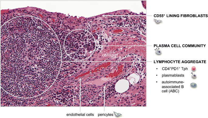 Synovial Tissue: Cellular and Molecular Phenotyping | SpringerLink