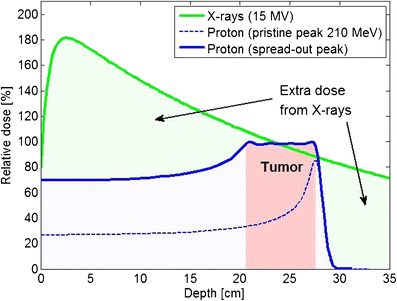 Proton Beam Radiation Therapy For Prostate Cancer Is The Hype And The Cost Justified Springerlink