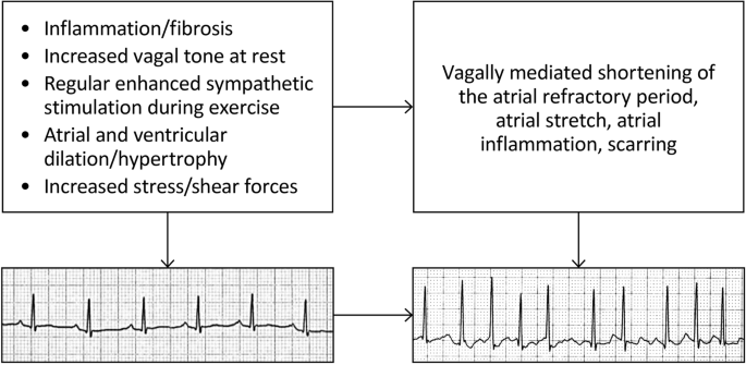 The “Extreme Exercise Hypothesis”: Recent Findings and Cardiovascular  Health Implications | SpringerLink