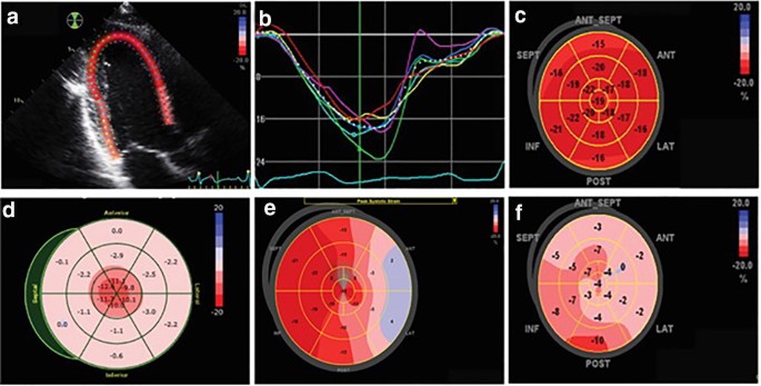 Frontiers  Myocardial strain analysis of echocardiography based on deep  learning