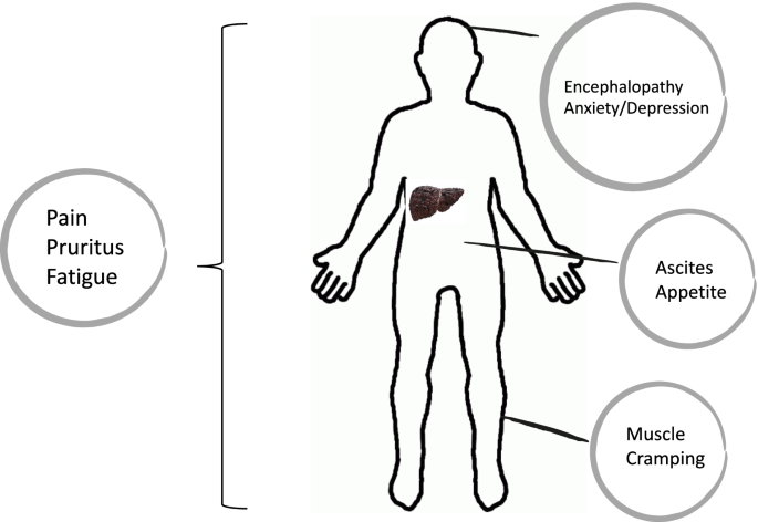 liver cirrhosis symptoms