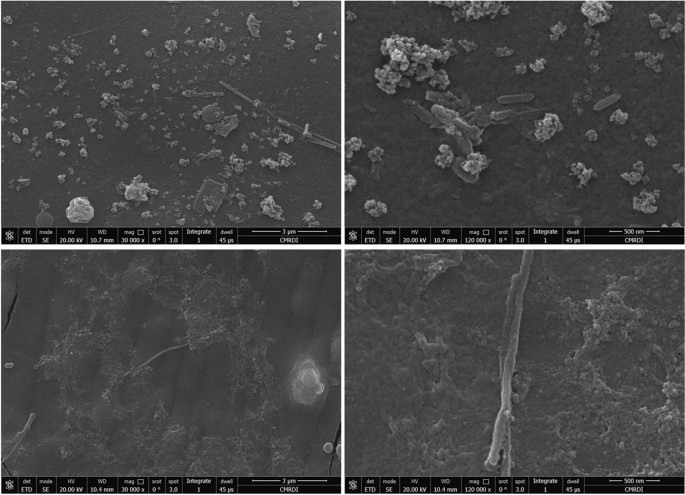 Toward Cnt Reinforced Chitosan Based Ceramic Composite Coatings On Biodegradable Magnesium For Surgical Implants Springerlink
