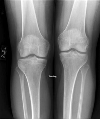 A 26 Year Old Woman With Bilateral Leg Pain And Pruritus Springerlink