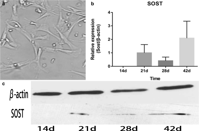 Different Effects Of Fluoride Exposure On The Three Major Bone Cell Types Springerlink