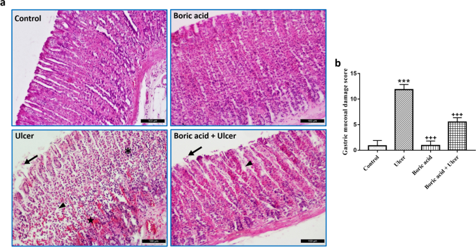 Boric Acid Alleviates Gastric Ulcer by Regulating Oxidative Stress and Inflammation-Related Multiple Signaling Pathways | Biological Trace Element Research