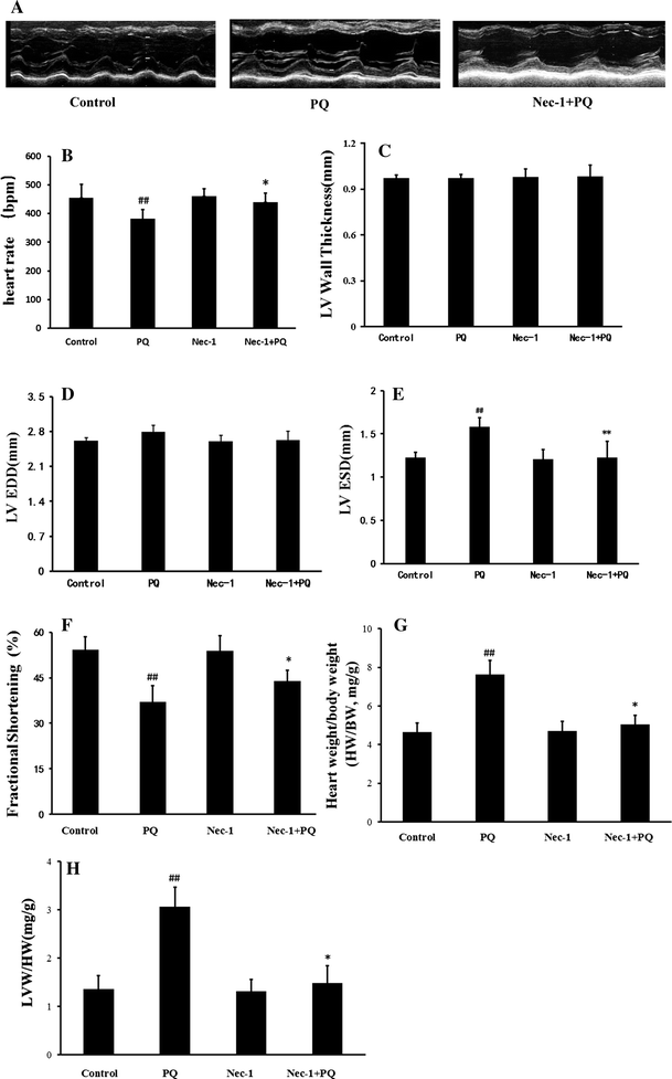 Necrostatin 1 Protects Against Paraquat Induced Cardiac Contractile Dysfunction Via Rip1 Rip3 Mlkl Dependent Necroptosis Pathway Springerlink