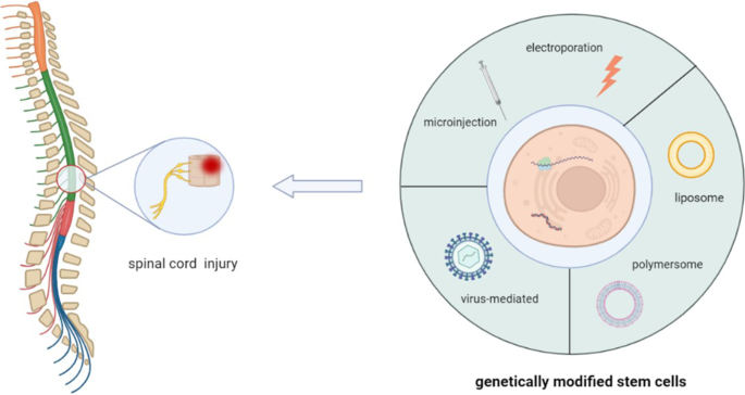 Gene-Modified Stem Cells for Spinal Cord Injury: a Promising Better  Alternative Therapy | SpringerLink