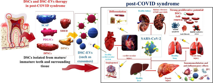 The Role of Dental-derived Stem Cell-based Therapy and Their 