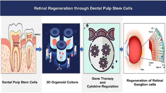 Enhancing Retinal Regeneration through Dental Pulp Stem Cells -Based 3D ...