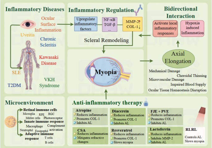 Inflammation and Immune Pathways in Myopia: An Overview on ...