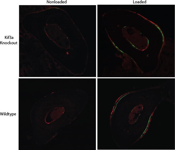 Primary Cilia Mediated Mechanotransduction In Bone Springerlink