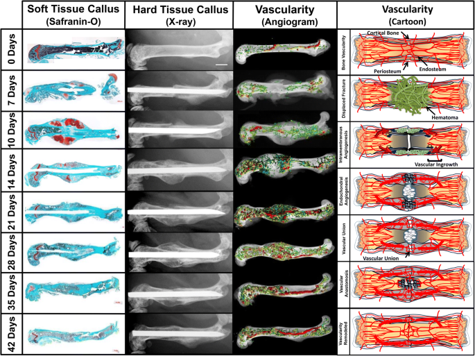 Bone Fracture Acute Phase Response A Unifying Theory Of Fracture Repair Clinical And Scientific Implications Springerlink