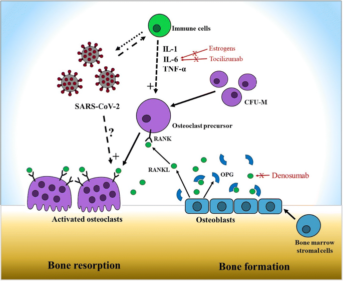 Bone Metabolism In Sars Cov 2 Disease Possible Osteoimmunology And Gender Implications Springerlink