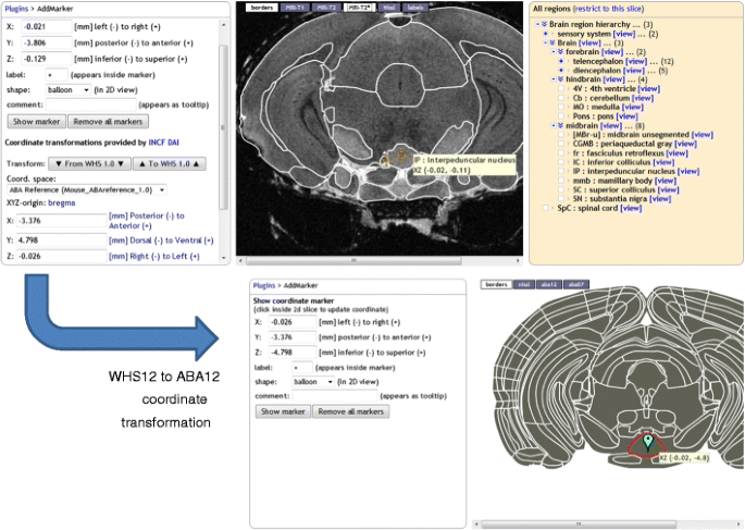 The Scalable Brain Atlas: Instant Web-Based Access to Public Brain ...