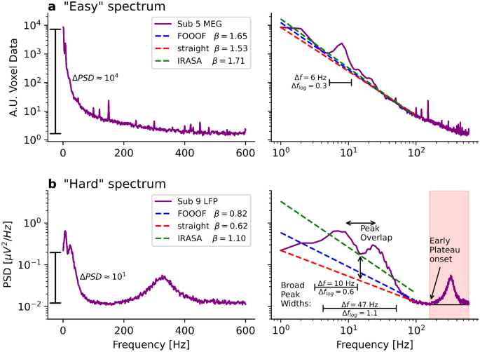 Separating Neural Oscillations From Aperiodic 1 F Activity Challenges And Recommendations Springerlink