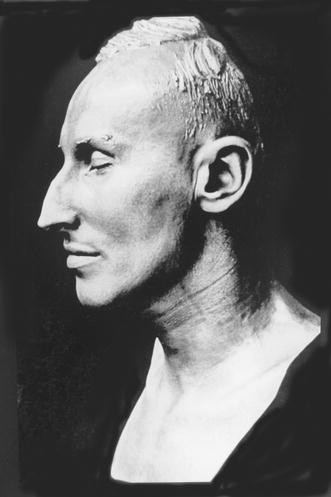 The autopsy of Reinhard Heydrich | SpringerLink