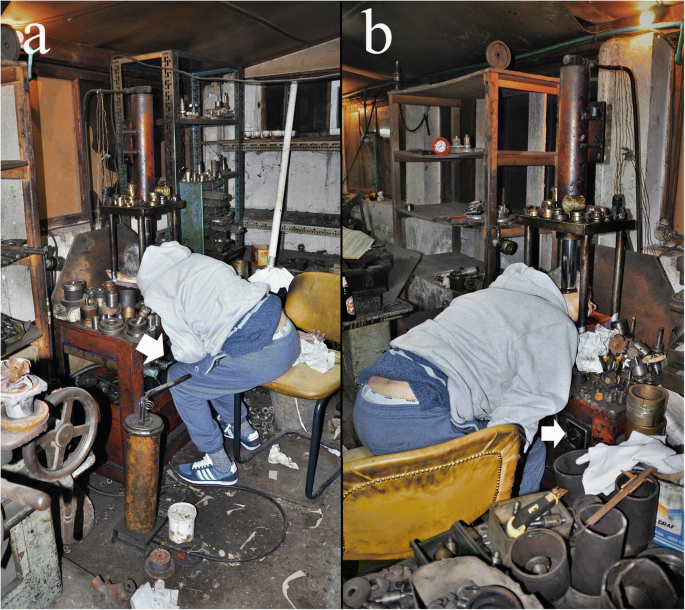 Suicidal Head Impalement With A Hydraulic Press Machine Occupation Related Suicide In A Psychiatric Patient Springerlink