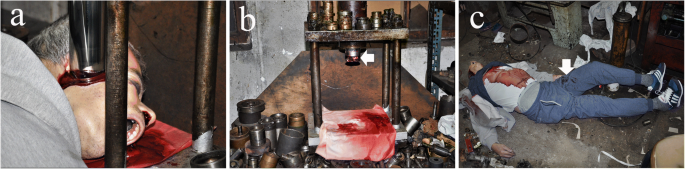 Suicidal Head Impalement With A Hydraulic Press Machine Occupation Related Suicide In A Psychiatric Patient Springerlink