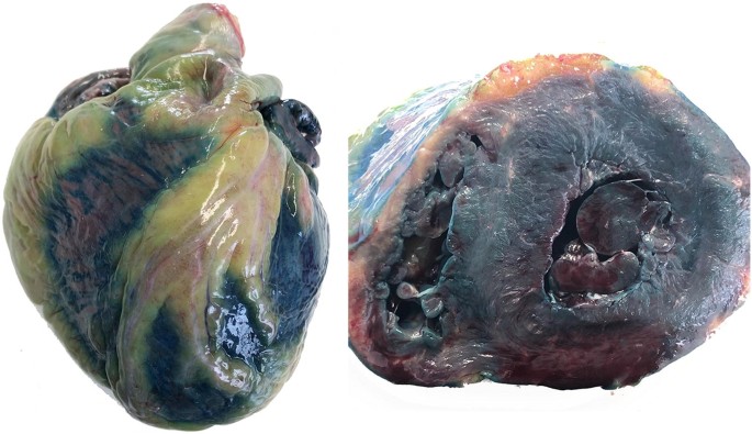 How Does Methylene Blue Affect The Brain?