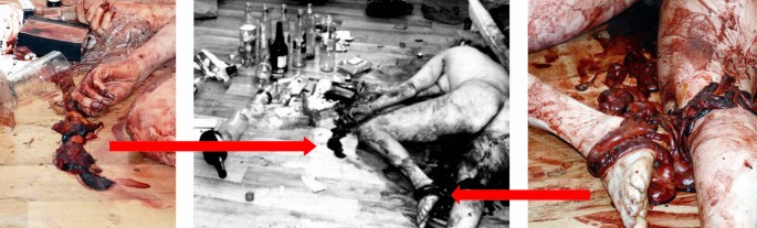 Bloody Anal Videos - Anal Punishment Bloody | BDSM Fetish