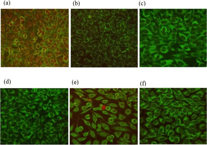 Clinical relevance and frequency of cytoplasmic patterns observed in ...