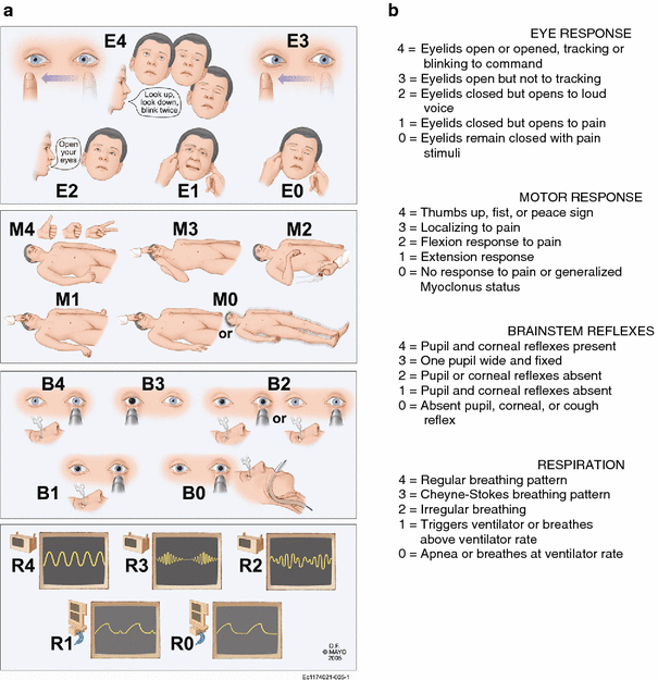 Validation of a New Coma Scale, the FOUR Score, in the Emergency Department  | SpringerLink