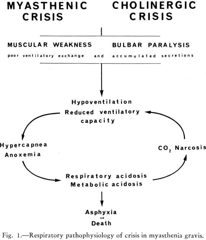 Breaking Down Myasthenic Crisis | SpringerLink