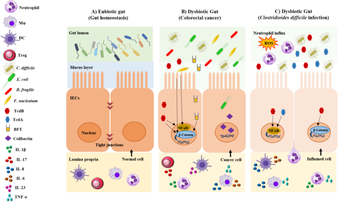 C. difficile Infection in Colorectal Cancer: Risk Determinants ...