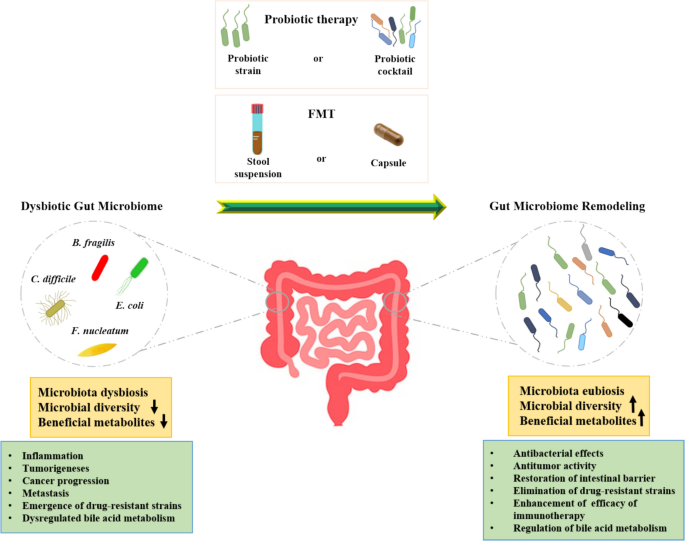 C. difficile Infection in Colorectal Cancer: Risk Determinants ...