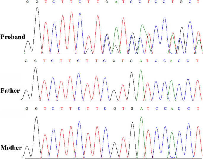 Mosaic CREBBP mutation causes overlapping clinical features of Rubinstein–Taybi  and Filippi syndromes