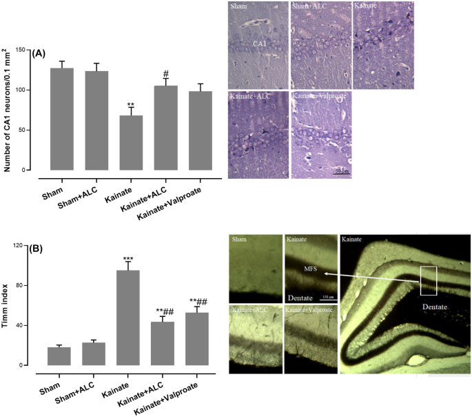 Acetyl-L-Carnitine Exerts Neuroprotective and Anticonvulsant Effect in  Kainate Murine Model of Temporal Lobe Epilepsy | Journal of Molecular  Neuroscience