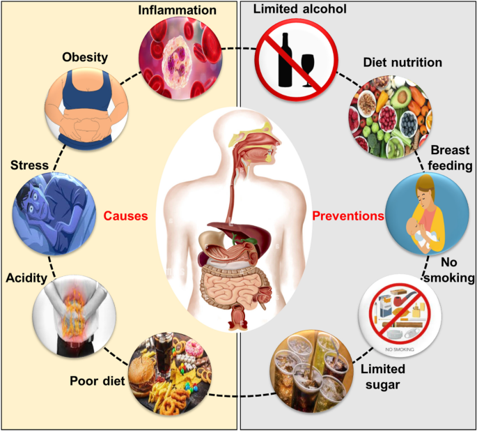 The role of nutrition in harnessing the immune system: a potential approach to prevent cancer | SpringerLink