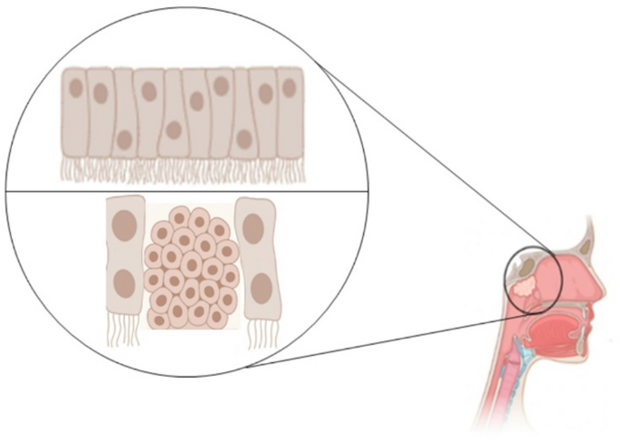 Epigenomic landscape of nasopharyngeal carcinoma | Medical Oncology ...