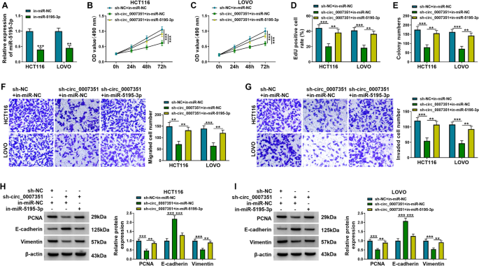 Circ_0007351 Exerts an Oncogenic Role In Colorectal Cancer Depending on the Modulation of the miR-5195-3p/GPRC5A Cascade | Molecular Biotechnology circ-0007351-exerts-an-oncogenic-role-in-colorectal-cancer-depending-on-the-modulation-of-the-mir-5195-3p-gprc5a-cascade-molecular-biotechnology
