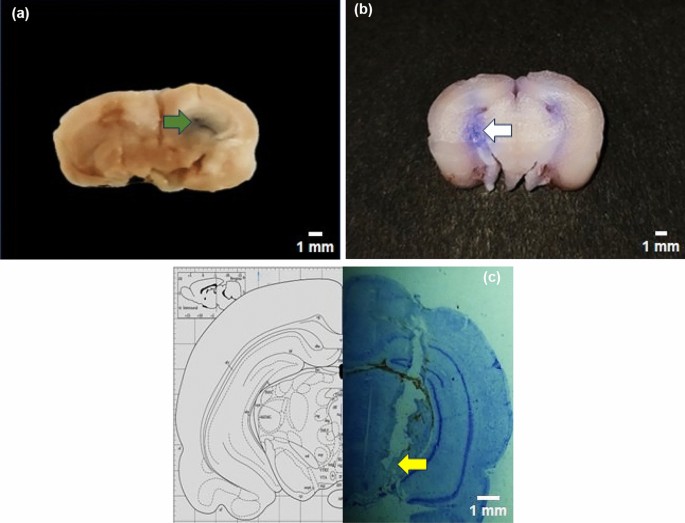 Design, fabrication and validation of a low-cost stereotaxic device for ...