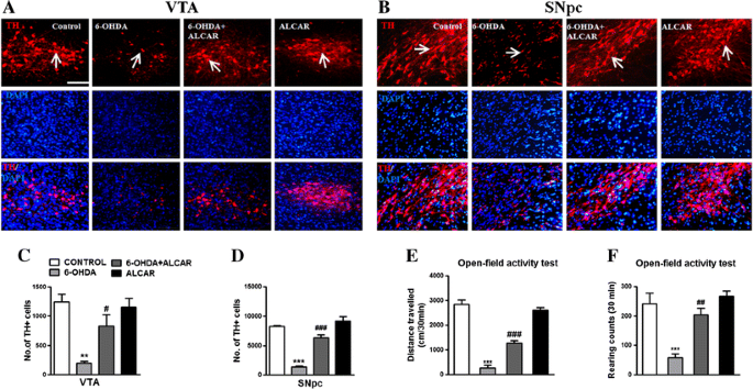 acetyl l carnitine dopamine Acetyl-l-Carnitine via Upegulating Dopamine D1 Receptor and Attenuating  Microglial Activation Prevents Neuronal Loss and Improves Memory Functions  in Parkinsonian Rats | Molecular Neurobiology