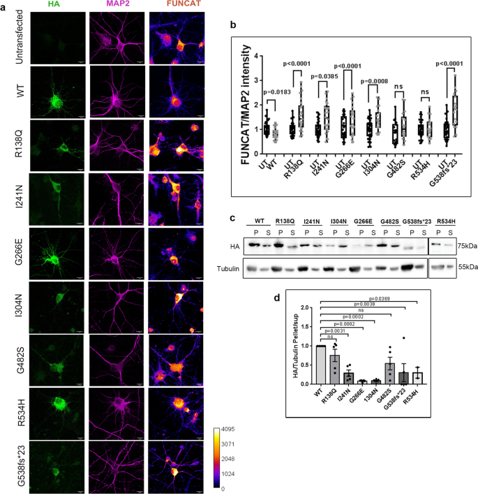 FMRP(1–297)-tat restores ion channel and synaptic function in a