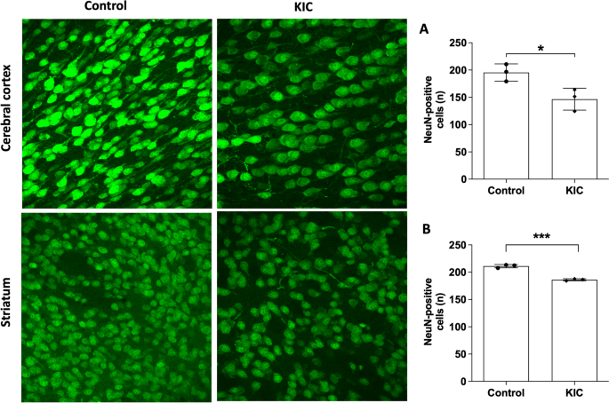 LIVE/DEAD Cell assay. a Control for live cells (normal astrocytes