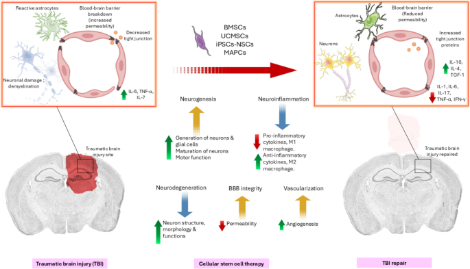 Cellular Stem Cell Therapy for Treating Traumatic Brain Injury ...