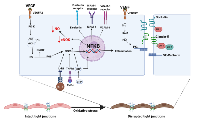 The Breakdown of Neurovascular Barriers: Molecular Mechanisms of Tight ...